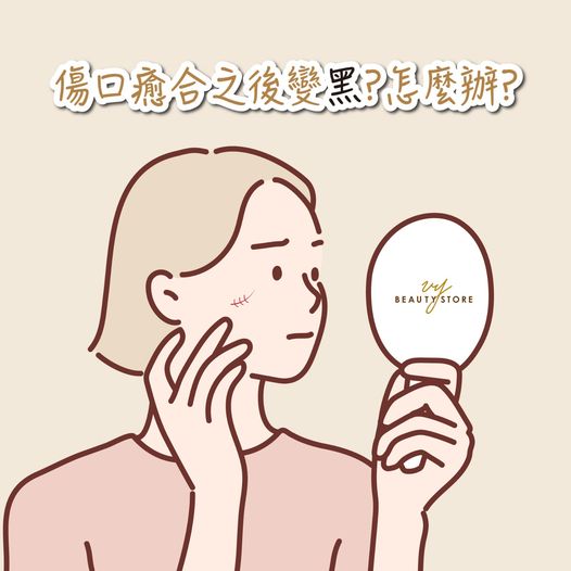 如何預防傷口癒合之後變黑