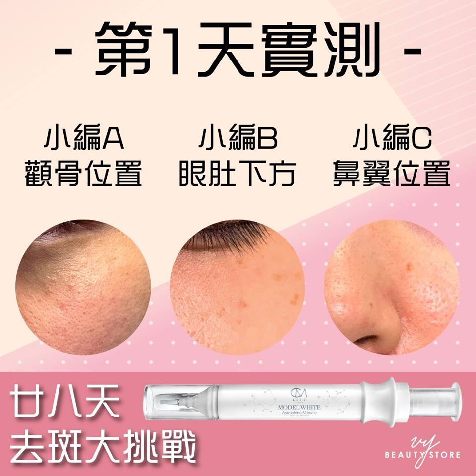 28日去斑美白實測—第1天的成果
