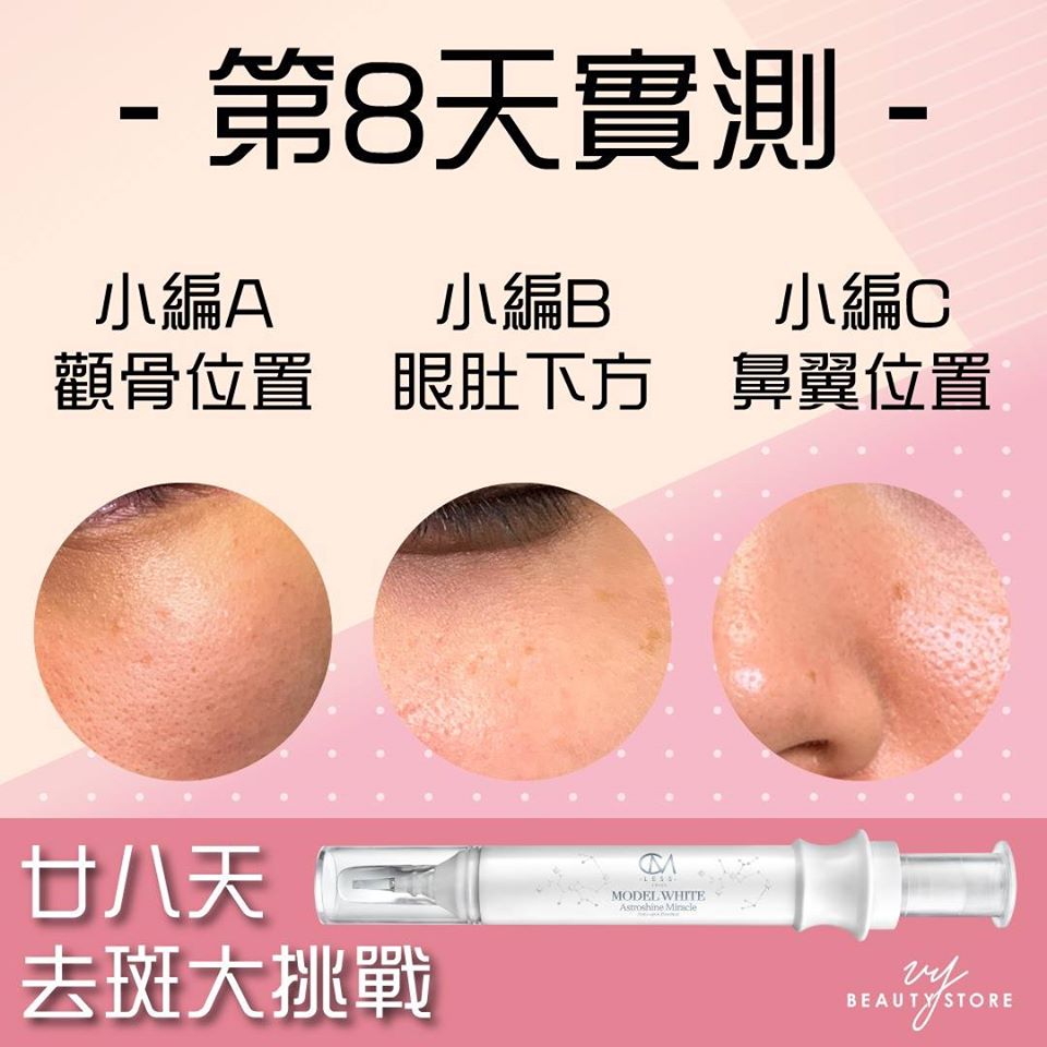 28日去斑美白實測—第8天的成果