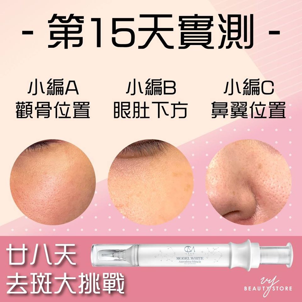 28日去斑美白實測—第15天的成果