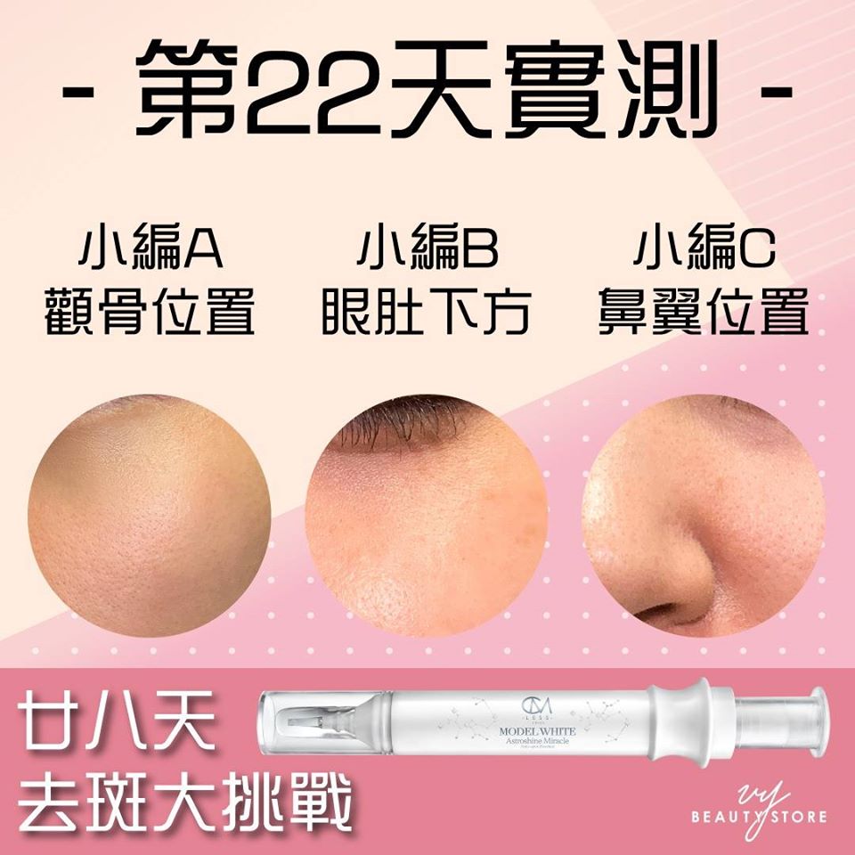 28日去斑美白實測—第22天的成果