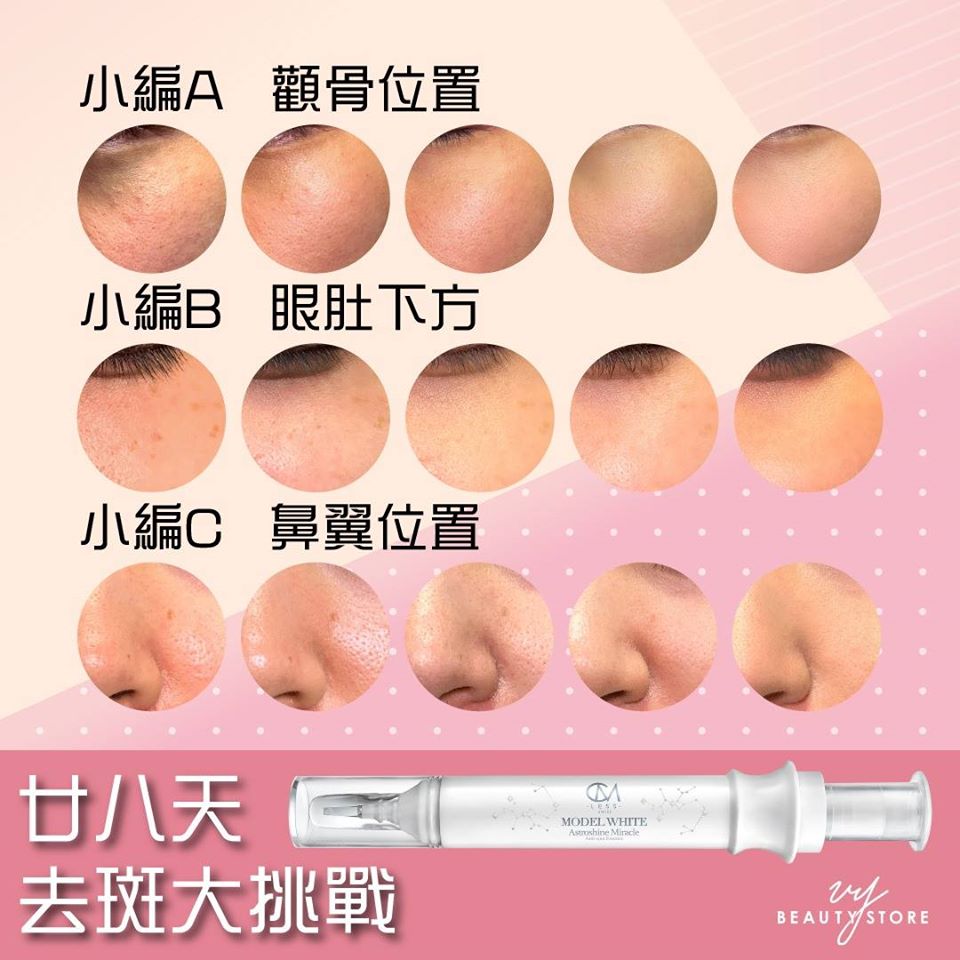 28日去斑美白實測大結局!天啊好緊張!到底結果是怎樣呢?