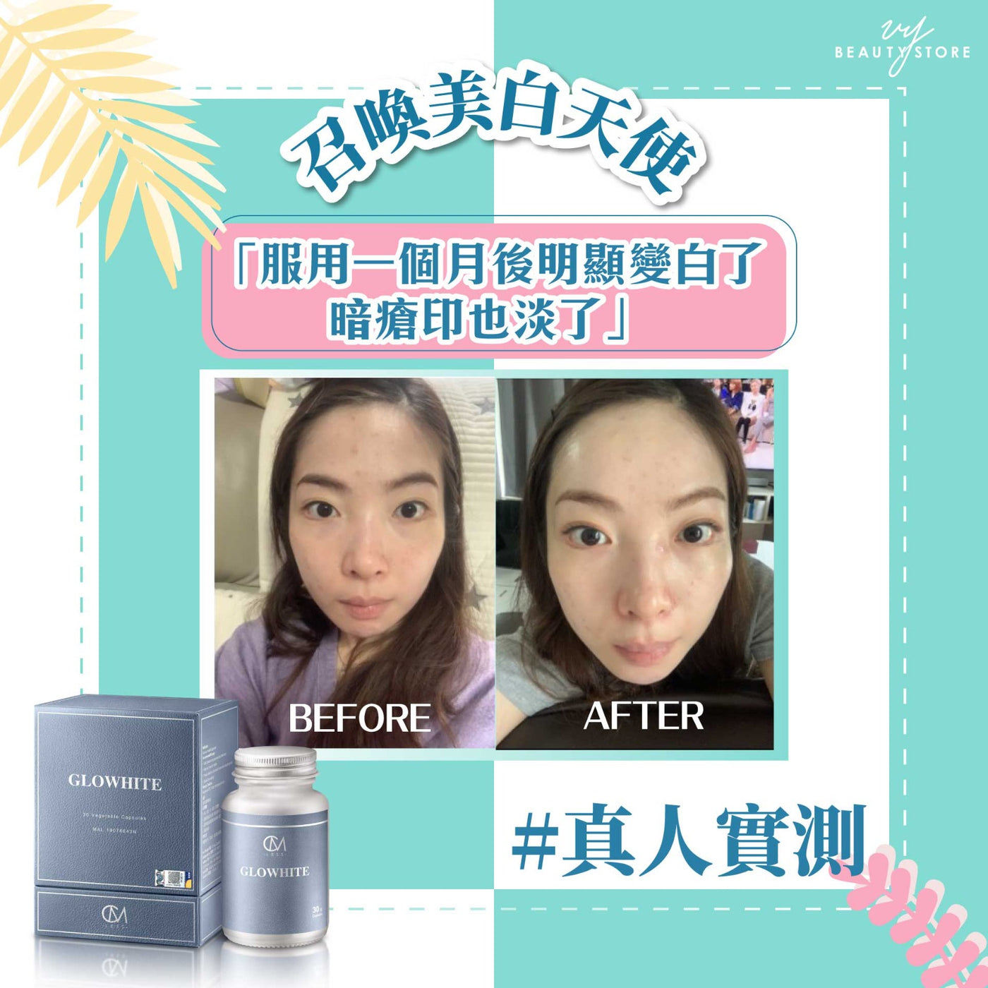 全身美白報告4 - 真人實測