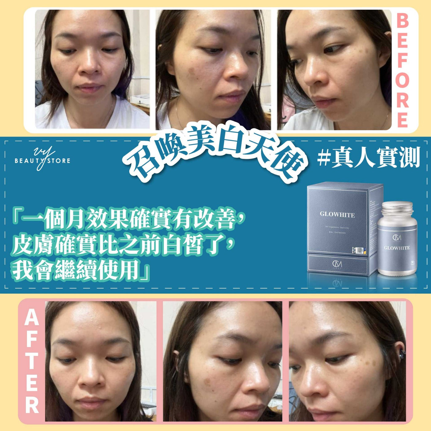 全身美白報告6-真人實測