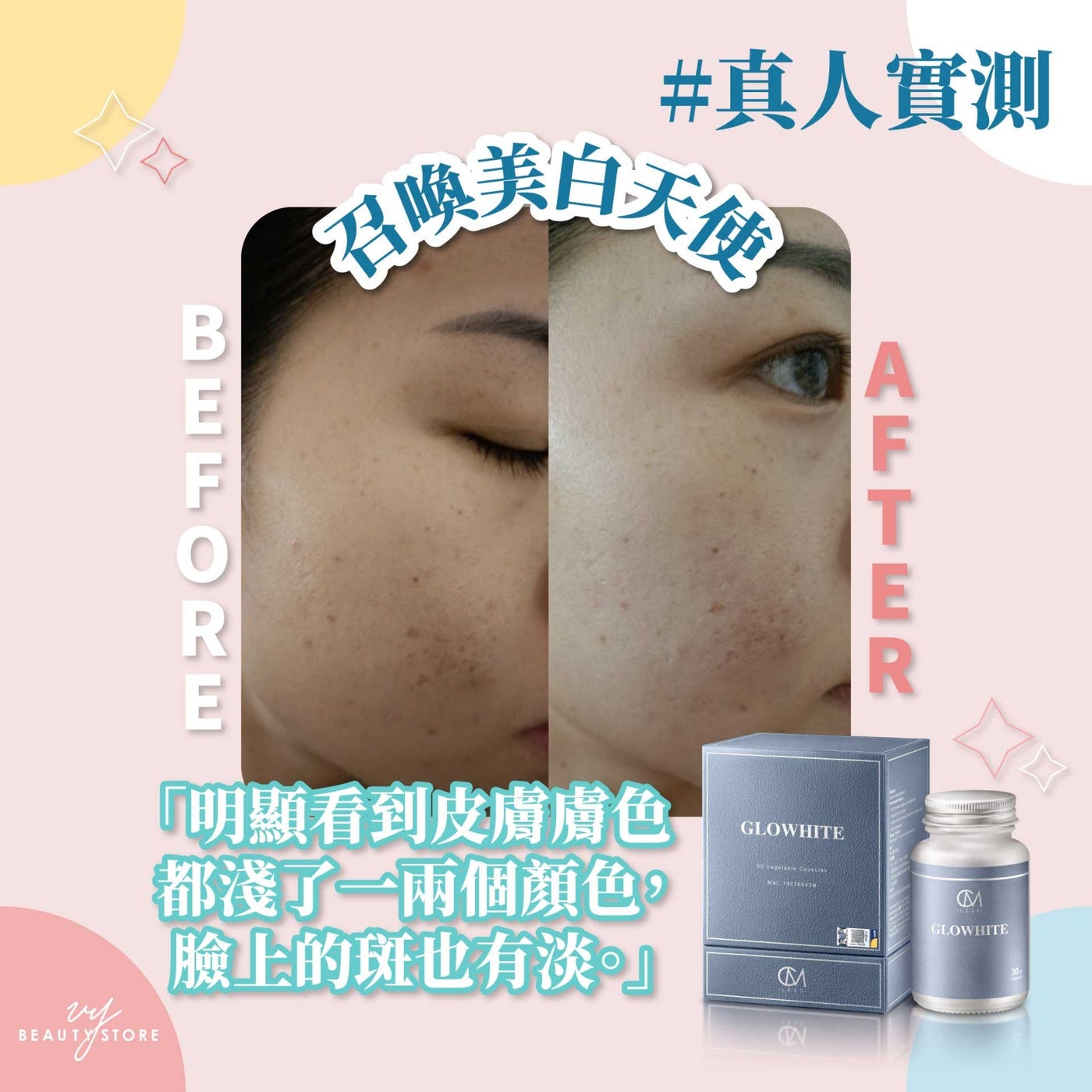 全身美白報告5-真人實測