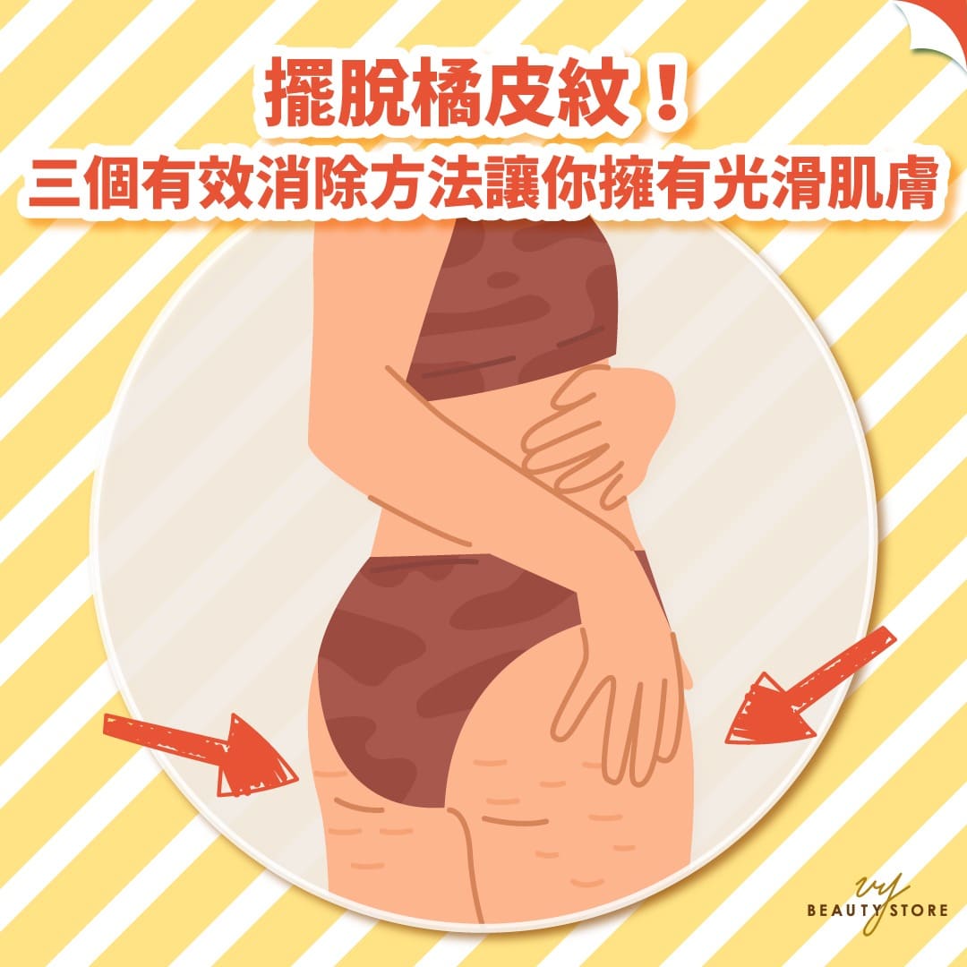 擺脫橘皮紋!三個有效消除方法讓你擁有光滑肌膚